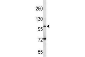 PSMA antibody western blot analysis in ZR-75-1 lysate. (PSMA 抗体  (AA 161-190))