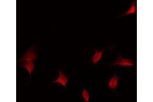ABIN6267587 staining Hela by IF/ICC. (RUNX1 抗体  (pSer276))