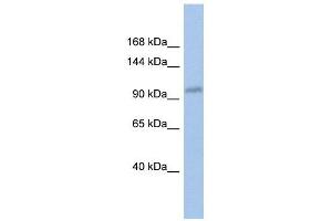 DDX24 antibody used at 1 ug/ml to detect target protein. (DDX24 抗体)