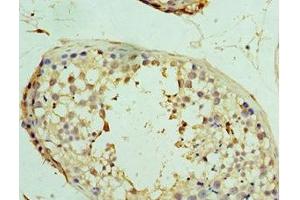 Immunohistochemistry of paraffin-embedded human testis tissue using ABIN7174360 at dilution of 1:100 (USP8 抗体  (C-Term))