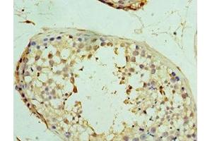 Immunohistochemistry of paraffin-embedded human testis tissue using ABIN7174360 at dilution of 1:100