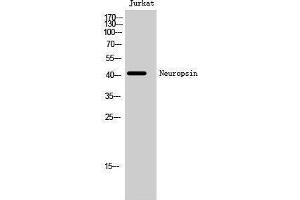 Western Blotting (WB) image for anti-Opsin 5 (OPN5) (C-Term) antibody (ABIN3185858) (OPN5 抗体  (C-Term))