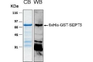 10% SDS-PAGE stained with Coomassie Blue (CB), immunobloting with anti-6xHis (WB) serum and peptide fingerprinting by MALDI-TOF-TOF mass spectrometry (Septin 5 Protein (SEPT5) (AA 1-369) (His-GST))