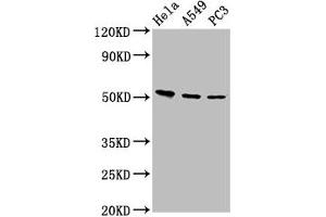 Western Blot Positive WB detected in: Hela whole cell lysate, A549 whole cell lysate, PC-3 whole cell lysate All lanes: ALS2CR12 antibody at 12 μg/mL Secondary Goat polyclonal to rabbit IgG at 1/50000 dilution Predicted band size: 53, 50 kDa Observed band size: 53 kDa (ALS2CR12 抗体  (AA 26-76))