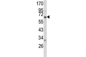 Western Blotting (WB) image for anti-Cytochrome P450, Family 2, Subfamily F, Polypeptide 1 (CYP2F1) (AA 395-424) antibody (ABIN3030688)