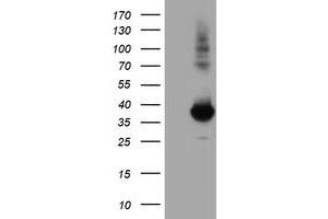 Western Blotting (WB) image for anti-Monoglyceride Lipase (MGLL) antibody (ABIN1499443) (MGLL 抗体)
