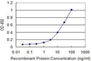 Detection limit for recombinant GST tagged SFMBT1 is 0. (SFMBT1 抗体  (AA 121-230))