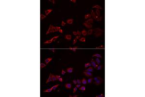 Immunofluorescence analysis of U2OS cells using NRBF2 antibody. (NRBF2 抗体)