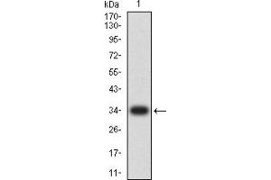 Western blot analysis using CCL4 mAb against human CCL4 (AA: 24-92) recombinant protein. (CCL4 抗体  (AA 24-92))