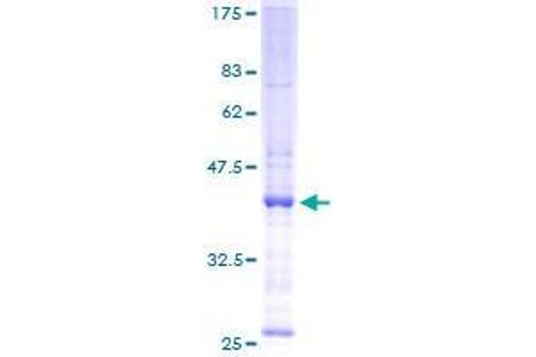 SNX5 Protein (AA 1-126) (GST tag)