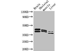 Western Blot Positive WB detected in: Mouse brain tissue, Mouse skeletal muscle tissue, Mouse liver tissue All lanes: ALDOC antibody at 3 μg/mL Secondary Goat polyclonal to rabbit IgG at 1/50000 dilution Predicted band size: 40 kDa Observed band size: 40, 36, 42 kDa (ALDOC 抗体  (AA 190-354))