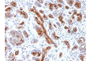 Formalin-fixed, paraffin-embedded human Pancreas stained with CFTR Monoclonal Antibody (CFTR/1341). (CFTR 抗体)