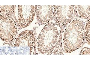 Immunohistochemistry of paraffin-embedded Rat testis tissue using Proliferating Cell Nuclear Antigen Monoclonal Antibody at dilution of 1:200.