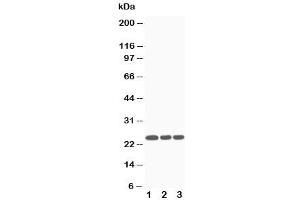 Western blot testing of SOCS3 antibody and Lane 1:  Jurkat (SOCS3 抗体  (Middle Region))