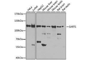Western blot analysis of extracts of various cell lines, using SART1 antibody. (SART1 抗体  (AA 1-255))