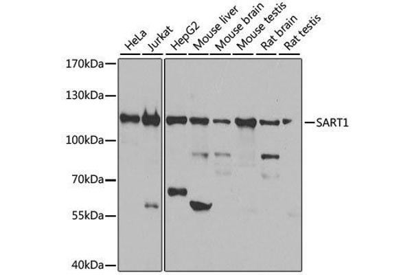 SART1 Antikörper  (AA 1-255)