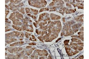 Immunoperoxidase of monoclonal antibody to CPB1 on formalin-fixed paraffin-embedded human pancreas. (CPB1 抗体  (AA 14-417))
