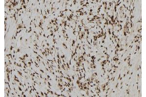 ABIN6278399 at 1/100 staining Human gastric tissue by IHC-P. (RAE1 抗体  (C-Term))