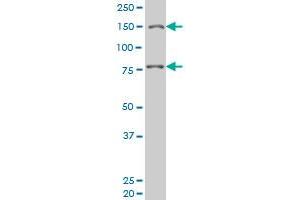 LRRFIP1 monoclonal antibody (M08), clone 3E1 Western Blot analysis of LRRFIP1 expression in Hela S3 NE . (LRRFIP1 抗体  (AA 675-784))