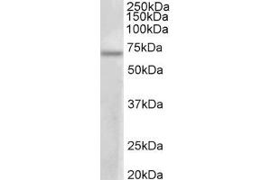 ABIN5539657 (1µg/ml) staining of MCF7 lysate (35µg protein in RIPA buffer). (PRMT3 抗体  (AA 468-421))