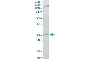 ATG5 monoclonal antibody (M04), clone 1G11. (ATG5 抗体  (AA 176-275))