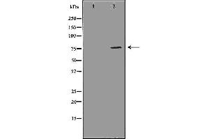 Western blot analysis of MDA MB 361 cell lysate, using ATF6 Antibody. (ATF6 抗体  (Internal Region))