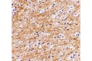 Immunohistochemistry (IHC) image for anti-Apoptosis-Inducing Factor, Mitochondrion-Associated, 3 (AIFM3) (N-Term) antibody (ABIN1031221) (AIFM3 抗体  (N-Term))
