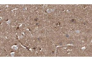 Immunohistochemistry (IHC) image for anti-Zinc and Ring Finger Protein 1 (ZNRF1) (Internal Region) antibody (ABIN6266142)