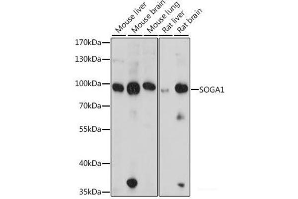 SOGA1 抗体
