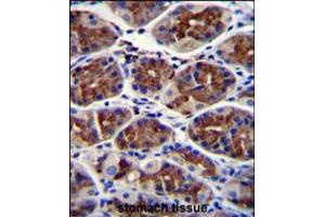EPHX3 Antibody immunohistochemistry analysis in formalin fixed and paraffin embedded human stomach tissue followed by peroxidase conjugation of the secondary antibody and DAB staining. (ABHD9 抗体  (C-Term))