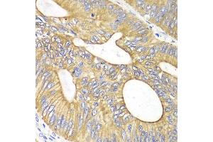 Immunohistochemistry (IHC) image for anti-Vascular Endothelial Growth Factor B (VEGFB) (AA 100-200) antibody (ABIN3023000) (VEGFB 抗体  (AA 100-200))