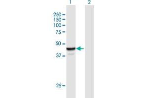 Western Blot analysis of NAPRT1 expression in transfected 293T cell line by NAPRT1 MaxPab polyclonal antibody. (NAPRT1 抗体  (AA 1-466))