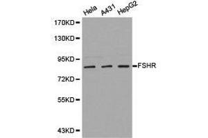 Western Blotting (WB) image for anti-Follicle Stimulating Hormone Receptor (FSHR) antibody (ABIN1872742) (FSHR 抗体)