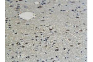 Formalin-fixed and paraffin embedded mouse brain labeled with Anti-Sphingomyelin Synthase 1 Polyclonal Antibody, Unconjugated  followed by conjugation to the secondary antibody and DAB staining (Sphingomyelin Synthase 1 抗体  (AA 331-413))
