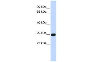 WB Suggested Anti-CTRB1 Antibody Titration:  0. (CTRB1 抗体  (Middle Region))