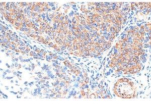 Immunohistochemistry of paraffin-embedded Rat ovary using TIMP2 Polyclonal Antibody at dilution of 1:100 (40x lens). (TIMP2 抗体)