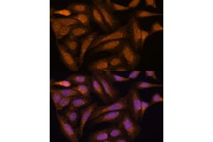 Immunofluorescence (IF) image for anti-Mitogen-Activated Protein Kinase Kinase 3 (MAP2K3) (AA 1-170) antibody (ABIN6143484)