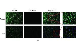 BOP1 expression is decreased in ASMCs of AD patients. (8-OHDG 抗体)