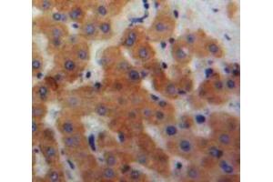 IHC-P analysis of Liver tissue, with DAB staining. (Ficolin 2 抗体  (AA 97-254))