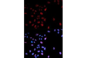 Immunofluorescence analysis of U2OS cell using Phospho-MYC-S62 antibody. (c-MYC 抗体  (pSer62))