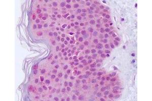 Anti-EGFR antibody IHC staining of human skin. (EGFR 抗体)
