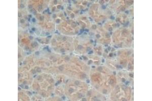 Used in DAB staining on fromalin fixed paraffin- embedded Kidney tissue (SNX18 抗体  (AA 411-614))