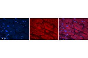 Immunohistochemistry (IHC) image for anti-Carboxylesterase 2 (CES2) (C-Term) antibody (ABIN2775271)