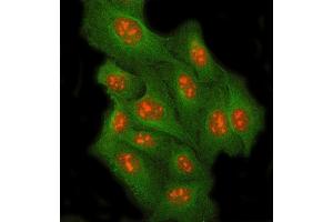 IF analysis of RRP8 and Tubulin beta using anti-RRP8 antibody (ABIN7600459) and anti-Tubulin beta antibody (ABIN7602744). (RRP8 抗体  (AA 199-456))