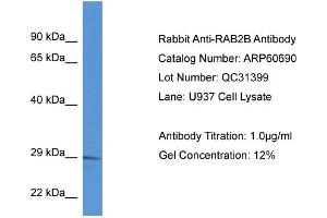 Western Blotting (WB) image for anti-RAB2B, Member RAS Oncogene Family (RAB2B) (C-Term) antibody (ABIN2788538) (RAB2B 抗体  (C-Term))