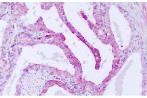 Image no. 2 for anti-serine/threonine Kinase 33 (STK33) (AA 34-83) antibody (ABIN6749787) (STK33 抗体  (AA 34-83))