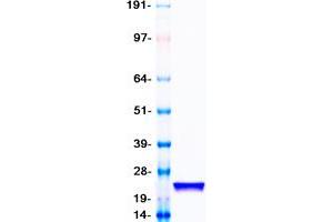 Western Blotting (WB) image for Superoxide Dismutase 1, Soluble (SOD1) protein (Myc-DYKDDDDK Tag) (ABIN2732994)