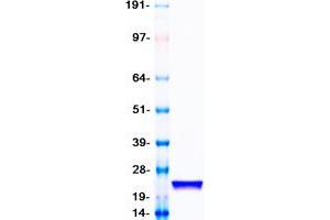 Validation with Western Blot (SOD1 Protein (Myc-DYKDDDDK Tag))