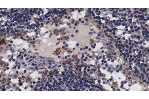 ABIN6266817 at 1/100 staining human Lymph node tissue sections by IHC-P. (NT5C3 抗体  (N-Term))