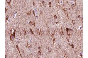 ABIN6266954 at 1/100 staining human brain tissue sections by IHC-P. (ZNF287 抗体)